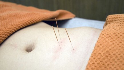 The best Acupuncture clinics in New Plymouth - Reviews and rates in New Zealand